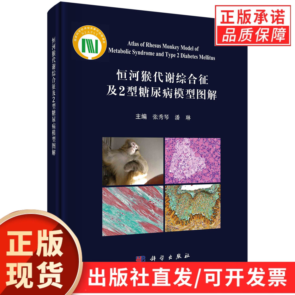 恒河猴代谢综合征及2型糖尿病模型图解