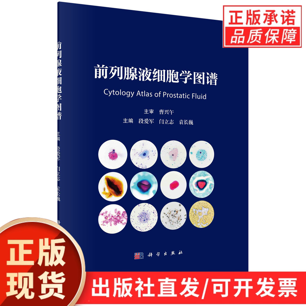 前列腺液细胞学图谱