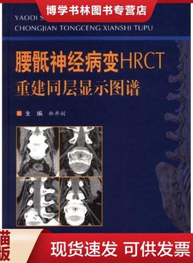 正版现货9787509157244腰骶神经病变HRCT重建同层显示图谱  林井副编  人民军医出版社