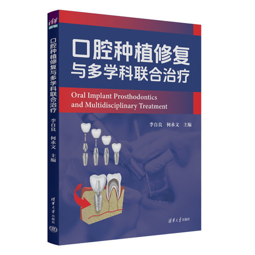 口腔种植修复与多学科联合治疗李自良  何永文五官科生活清华大学出版社