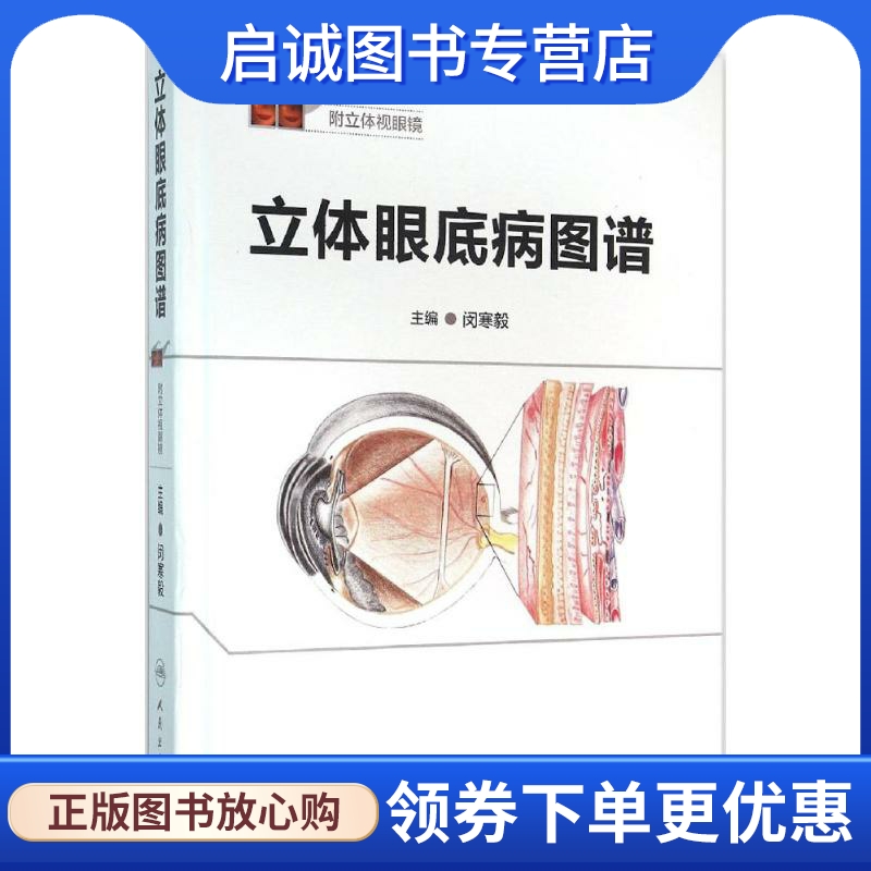 立体眼底病图谱 闵寒毅 主编 五官科 生活 人民卫生出版社