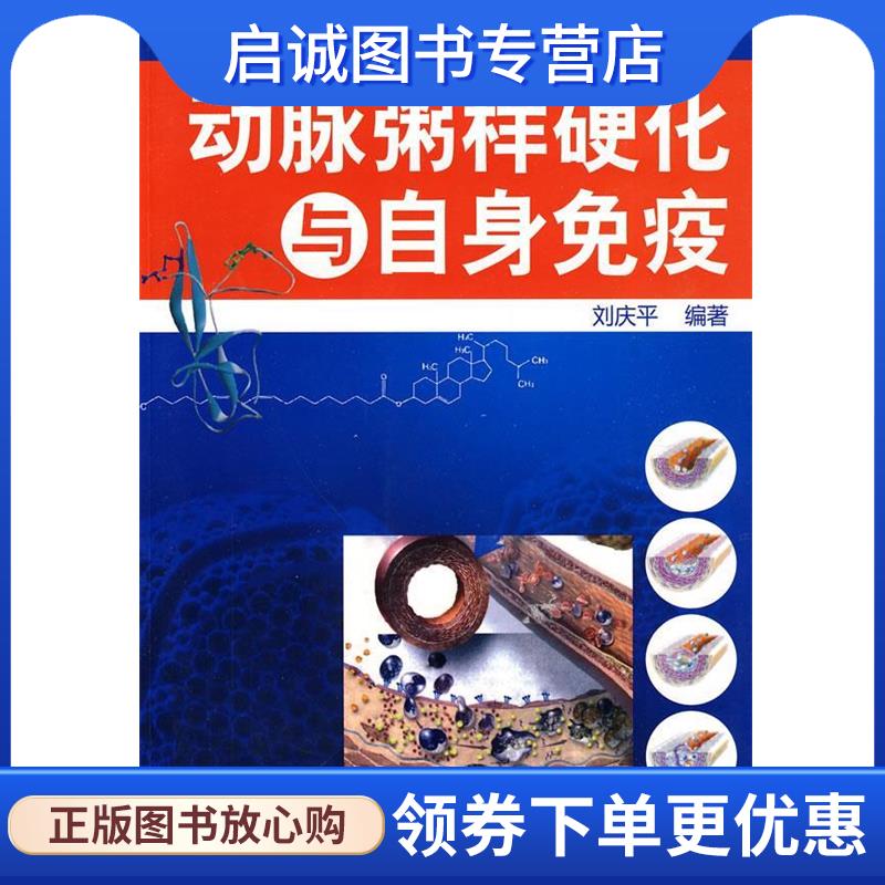 正版动脉粥样硬化与自身免疫 刘庆平　编著 9787122078780 化学工业出版社
