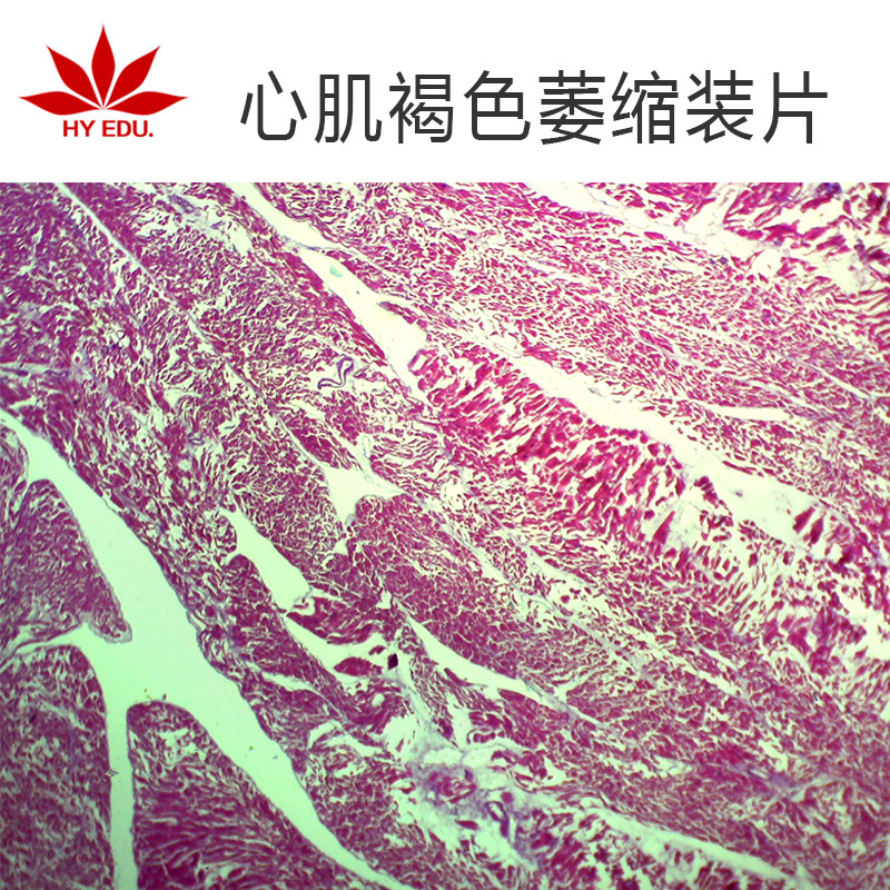 心肌褐色萎缩生物切片玻璃制高教教学病理切片成像清晰红叶出品