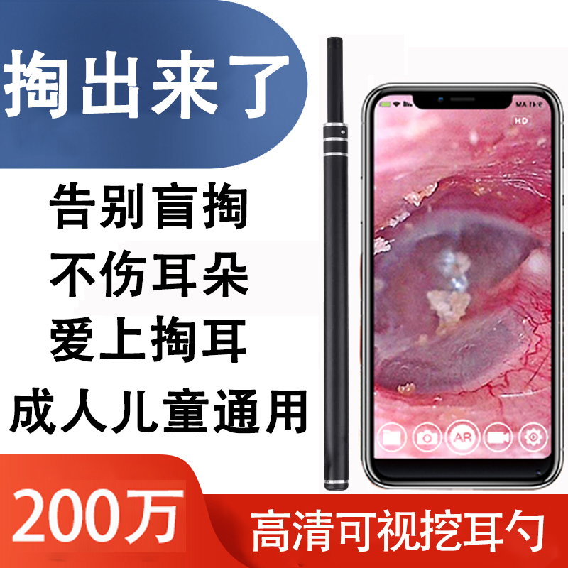 吸耳内镜赵医生同款可视挖耳勺神器高清掏耳勺内视镜采耳仪器耳镜