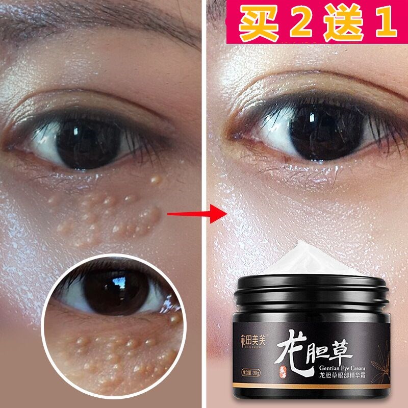 去面部汗管眼部瘤汗管眼霜瘤脂肪粒油脂粒祛除去面部眼部精华
