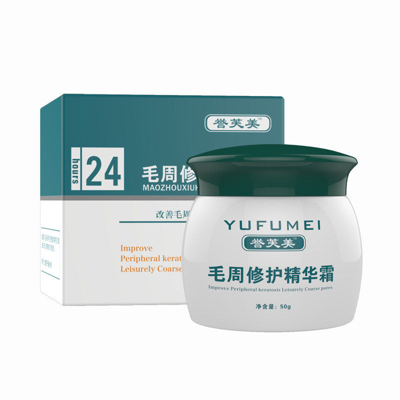 誉芙美去鱼鳞蛇皮鸡肤霜病祛除全身体乳疙瘩毛囊角质角干燥脱皮
