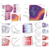 ceRNA调控网络lncRNA miRNA数据库挖掘