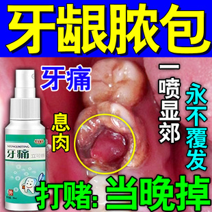 治牙痛脓包肿消痛炎牙周牙根周上火炎去蛀牙龋牙龈增生牙止痛喷剂