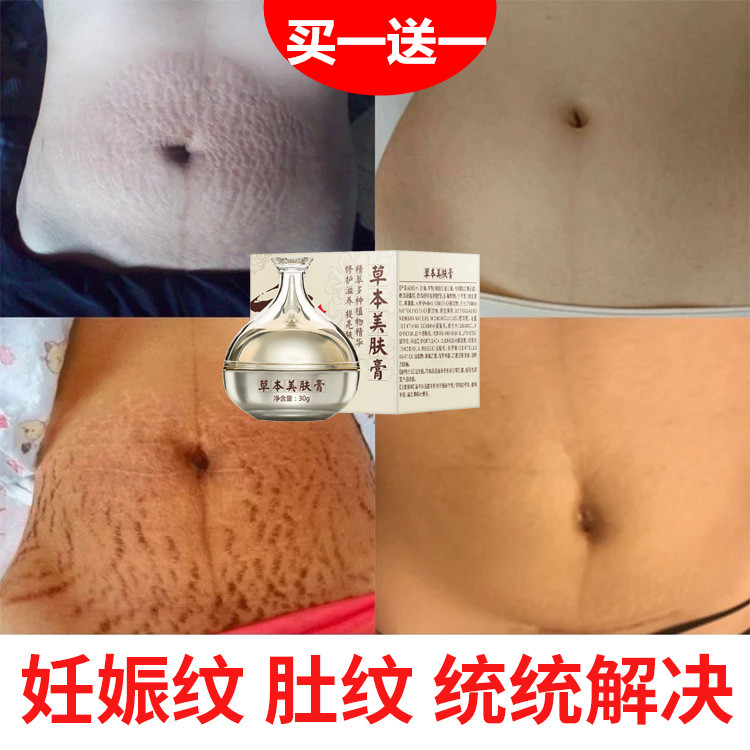 [d[s130674720]妊娠纹护理]去妊娠纹修复霜产后消除紧致肚皮祛肥胖月销量0件仅售99.67元