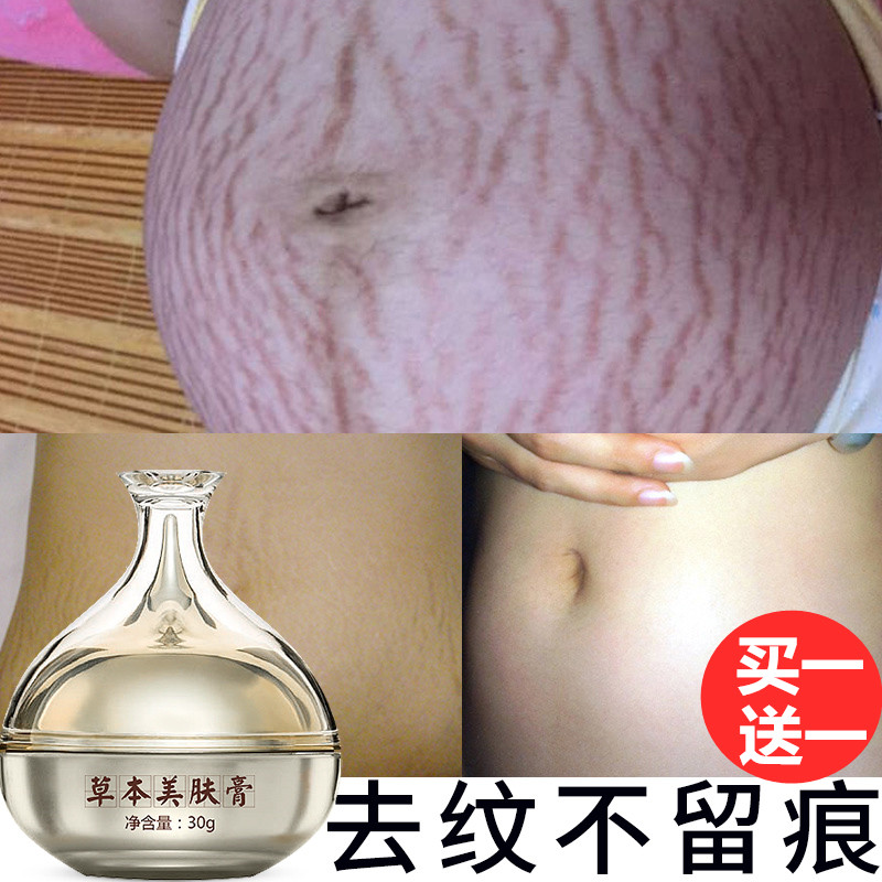 产后去妊娠纹修复霜淡化妊辰纹肥胖纹生长纹花肚皮身体乳霜