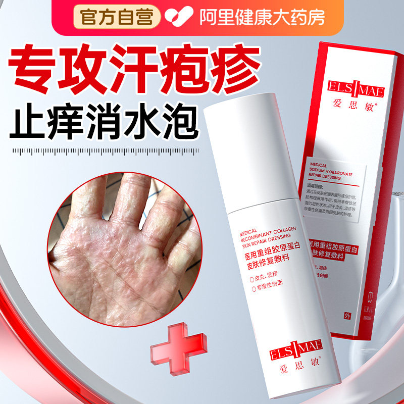 汗疱疹药手上长小水泡疙瘩脱皮止痒手气膏真菌感染药膏湿疹手指膏