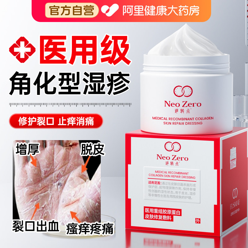 角化型手部湿疹专用止痒手足癣膏脱皮干裂真菌感染去鹅掌风手脱皮 - 实物图