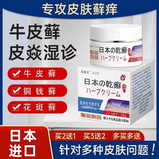芙康克乾廯25克日本膏皮肤瘙痒买二送一买三送二买五送四