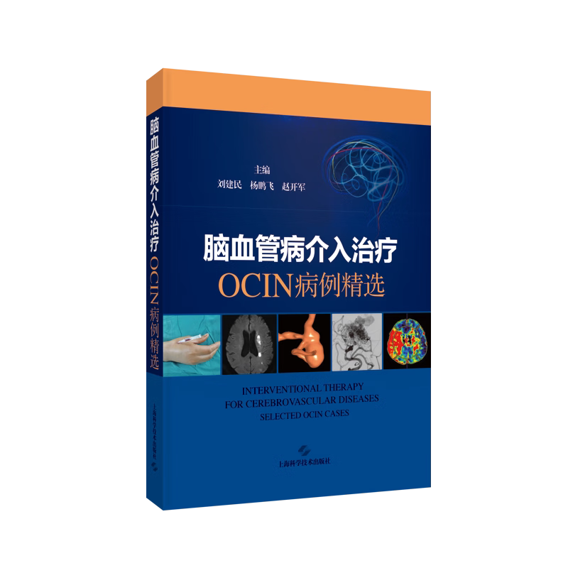 脑血管病介入治疗 OCIN 精选病例 刘建民 杨鹏飞 赵开军 内多家三甲医院脑血管病中心精心筛选的典型脑血管病病例 上海科技出版社