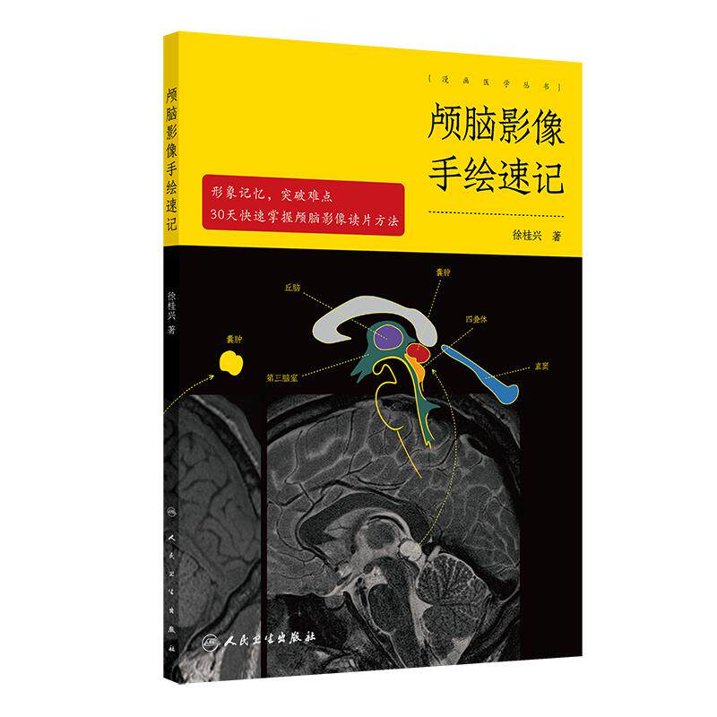 颅脑影像手绘速记 颅脑正常影像 高血压性脑出血 脑静脉出血和静脉窦血栓形成 颅内肿瘤 主编 徐桂兴 9787117364225人民卫生出版社
