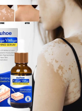 White Spot Treatment EssenceFade SpotsWhite Spot RepairEven