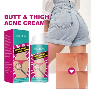 Clearing Acne Thigh Back Fades Body Cream Hip