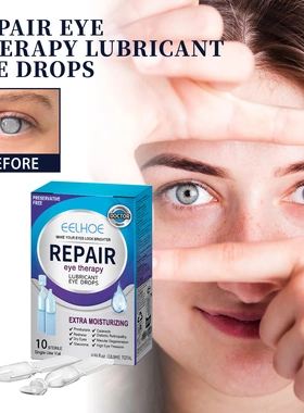 Eye Drops Relieve Eye Fatigue Dryness Blurring Gentle Moistu
