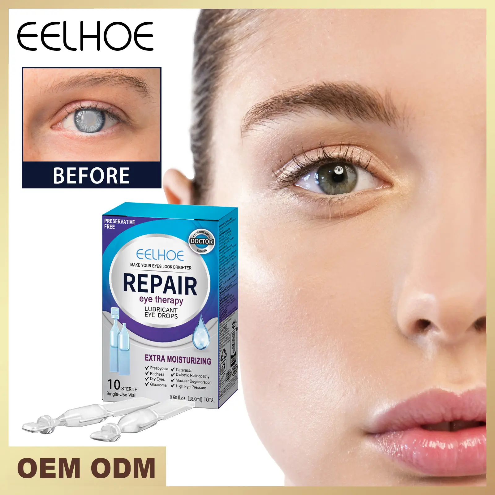 滴眼液深度清洁干涩痒视力模糊