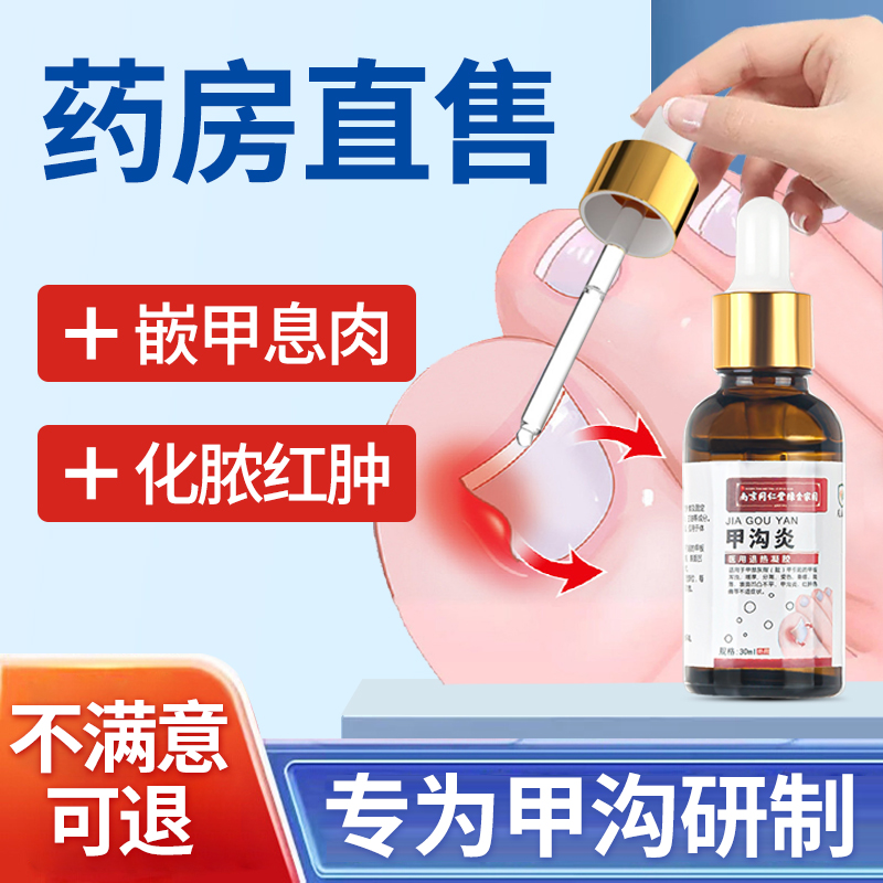 甲沟炎专用软甲消肿去肉芽脚趾治疗矫正器灰指甲软化剂息肉去除qx