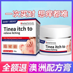 澳洲进口卡泊三醇倍他米乳软膏牛皮藓银屑药湿痒皮焱病疹荨麻止痒