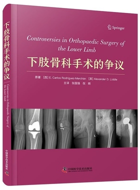 下肢骨科手术的争议 (西) E.卡洛斯·罗德里格斯 -默沙恩（E. Carlos Rodríguez-Merchán