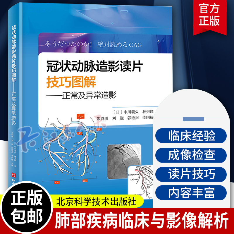 冠状动脉造影读片技巧图解 正常及异常造影 教你从冠脉造影小白 快速进阶PCI达人 北京科学技术出版社书籍