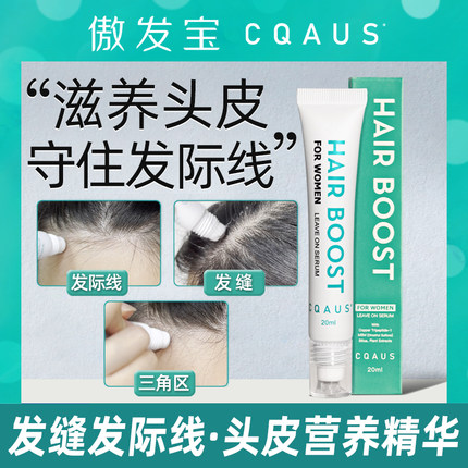 水油平衡头皮滋养液发际线营养精华液焕活毛囊护理头皮头发增长液