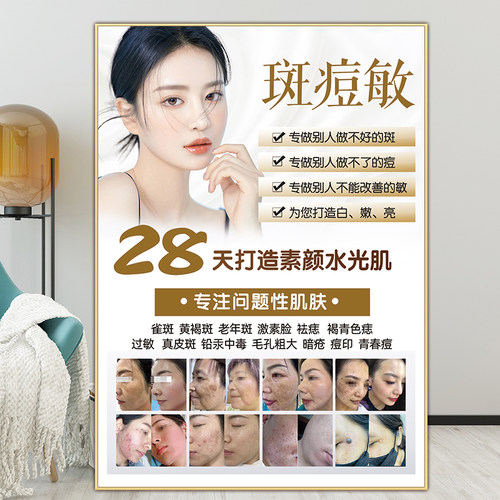 祛斑海报斑痘敏挂画问题肌肤广告