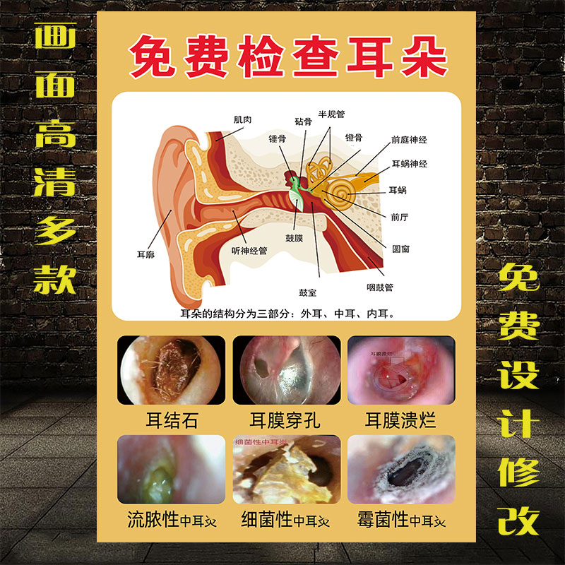 采耳广告图片常见耳病症状墙壁画中耳炎画挂墙免费检查耳朵海报图