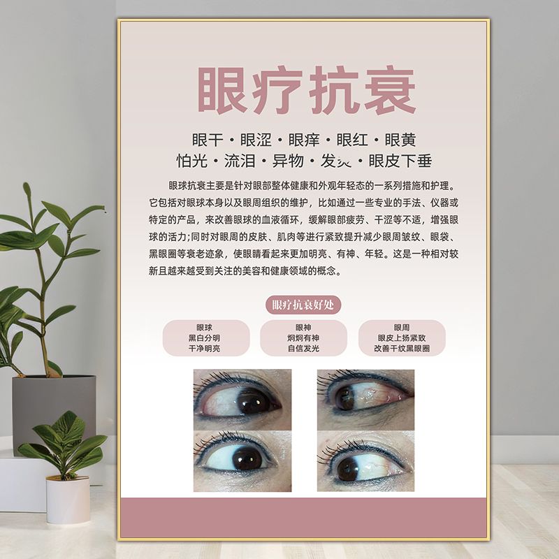眼疗海报眼球spa广告眼部护理画