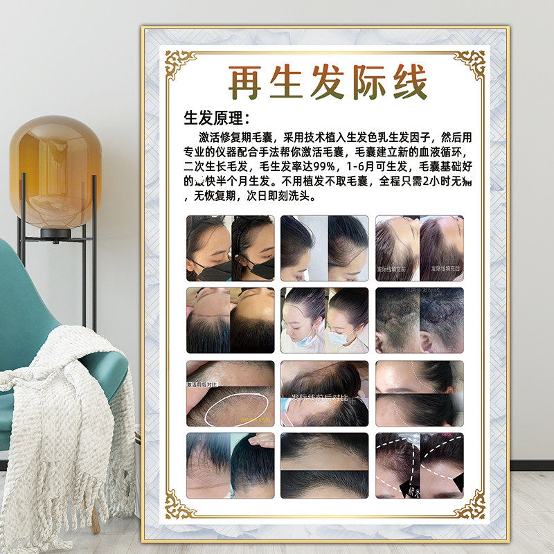 再生发际线海报白转黑挂画养发馆装饰画脱发广告图育发植发宣传画