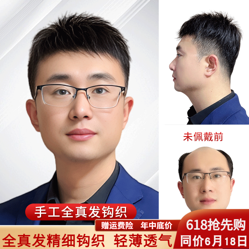 假发男士短发真发短毛寸男生遮盖头顶地中海男款透气补发片全手织