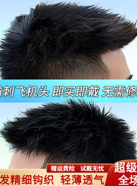 假发男头顶补发前刺男士