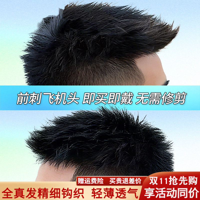 假发男头顶补发前刺男士