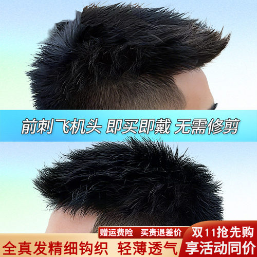 假发男头顶补发前刺男士