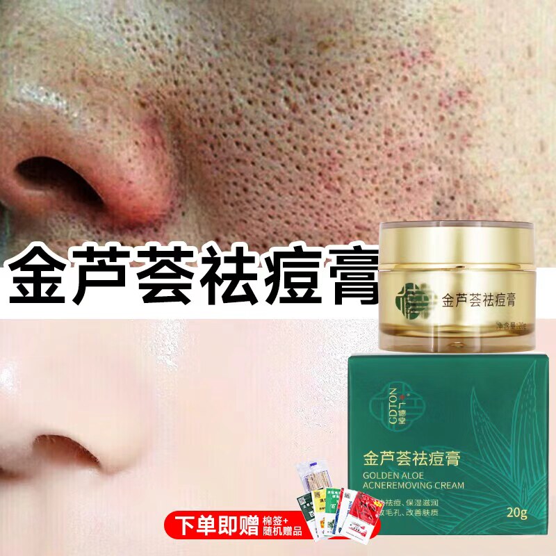 广德堂金芦荟胶祛痘膏草祛痘