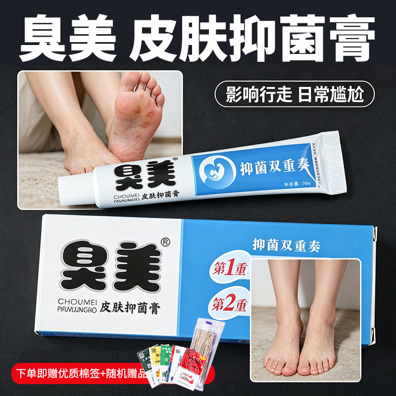 臭美官方脚气喷雾三合一皮肤抑菌液膏软乳香港脚广州康采专用脱皮