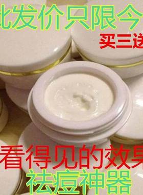 老款小白瓶祛痘珍珠膏强效去痘痘产品粉刺淡化痘印痤疮男女青春痘