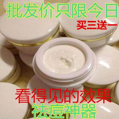 小白瓶祛痘珍珠膏正品强效去痘痘产品粉刺淡化痘印痤疮男女青春痘
