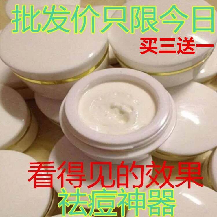 老款小白瓶祛痘珍珠膏强效去痘痘产品粉刺淡化痘印痤疮男女青春痘