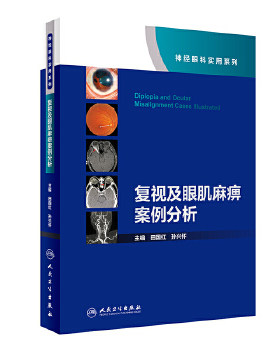 正版复视及眼肌麻痹案例分析