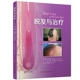 应对脱发 治疗脱发应用指南 段晓涵 脱发发病机制 临床表现 等译 脱发与治疗 张舒译 非医疗手段毛发移植 正版 诊断和治疗 书籍