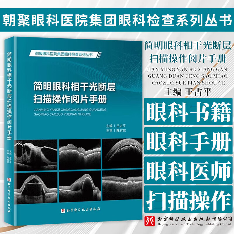 简明眼科相干光断层扫描操作手册