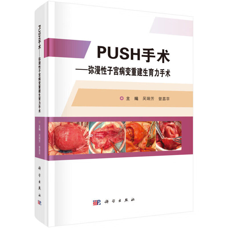 PUSH手术 弥漫性子宫病变重建生育力手术 弥漫性子宫病变概述 临床分型与影像学检查 生育功能损伤与生育力保护 病因与发病机制