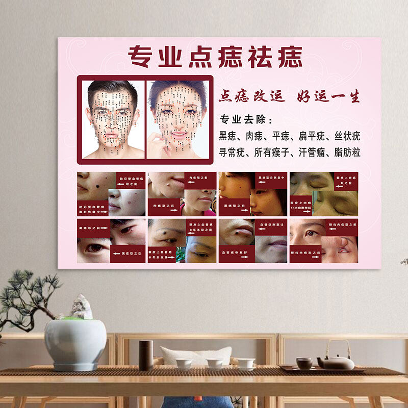 点痣图面部广告画祛痣图片挂图祛斑海报祛疣画男女面痣图kt板脸部