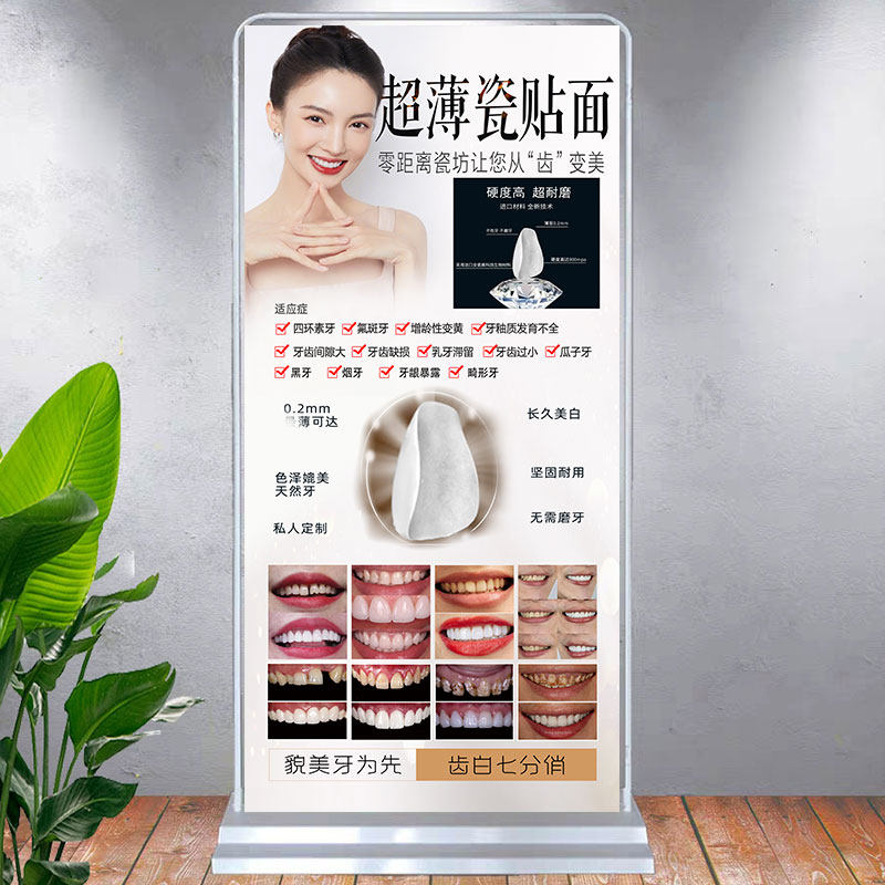 美牙贴片海报牙科挂画牙贴面图片全瓷牙齿美白展架超薄瓷贴面广告