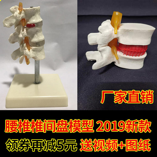人体腰椎间盘模型 专业演示脊椎关节模型 腰椎模型脊柱 正品包邮!