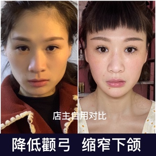 韦得洝新款瑞士改善高颧骨告别大饼脸骨法令纹克星咬肌水状