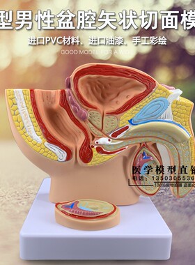 子宫卵巢 健康 模型生殖器解剖模型计生医用模型病理子宫模型 趣品店